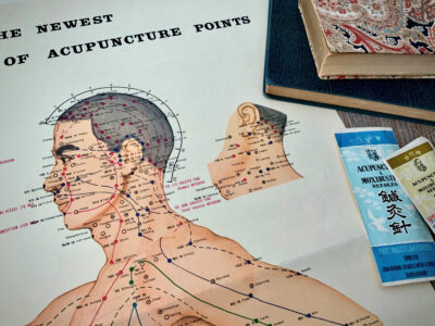Acupunctuurposter